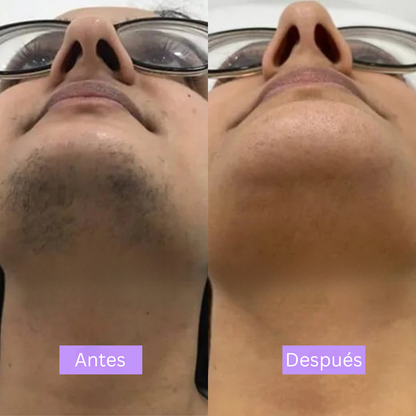 LinéaSkin™ - Serúm para los vellos de la piel Cyperus Rotundus