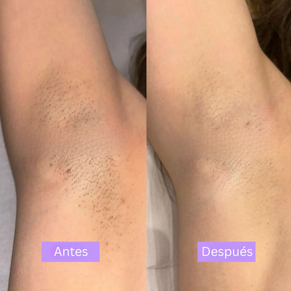 LinéaSkin™ - Serúm para los vellos de la piel Cyperus Rotundus